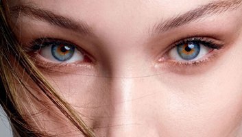 Chirurgia Fox eye