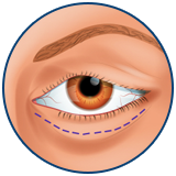 Fox eyes Turchia