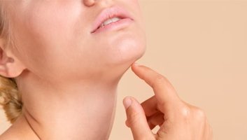 Liposuzione del doppio mento Turchia