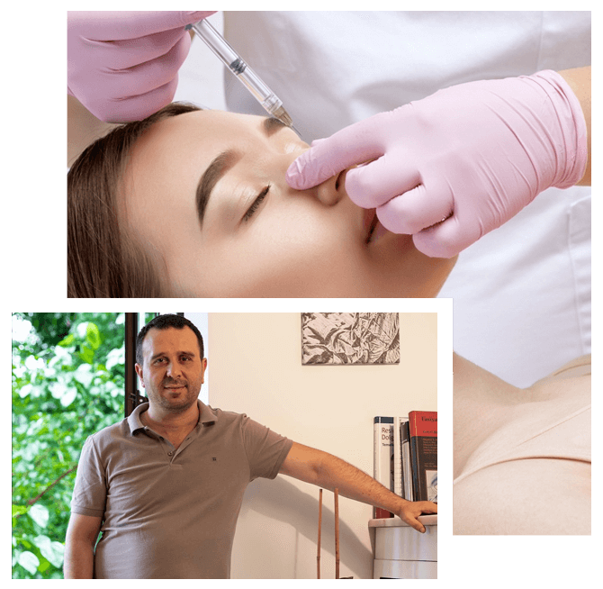 Cos'è la rinoplastica non chirurgica