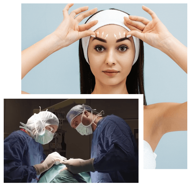 Cos'è un lifting delle sopracciglia?