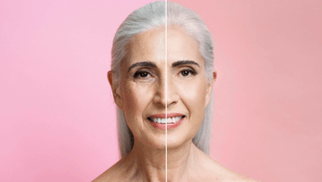 quali-metodi-vengono-utilizzati-in-un-lifting-facciale-cosmetico