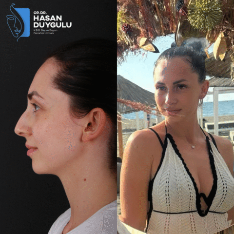 chirurgo-rinoplastico