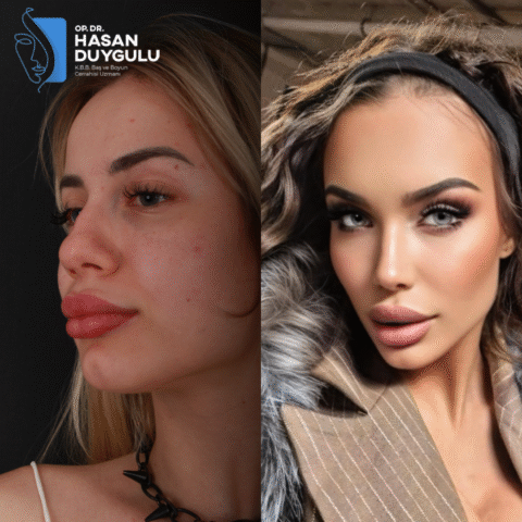 chirurgo-rinoplastico-turchia